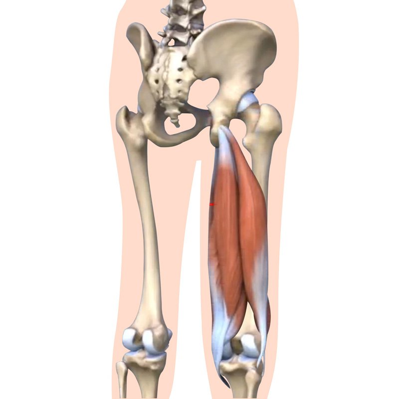 Hamstring Strain stage1 | Global Health