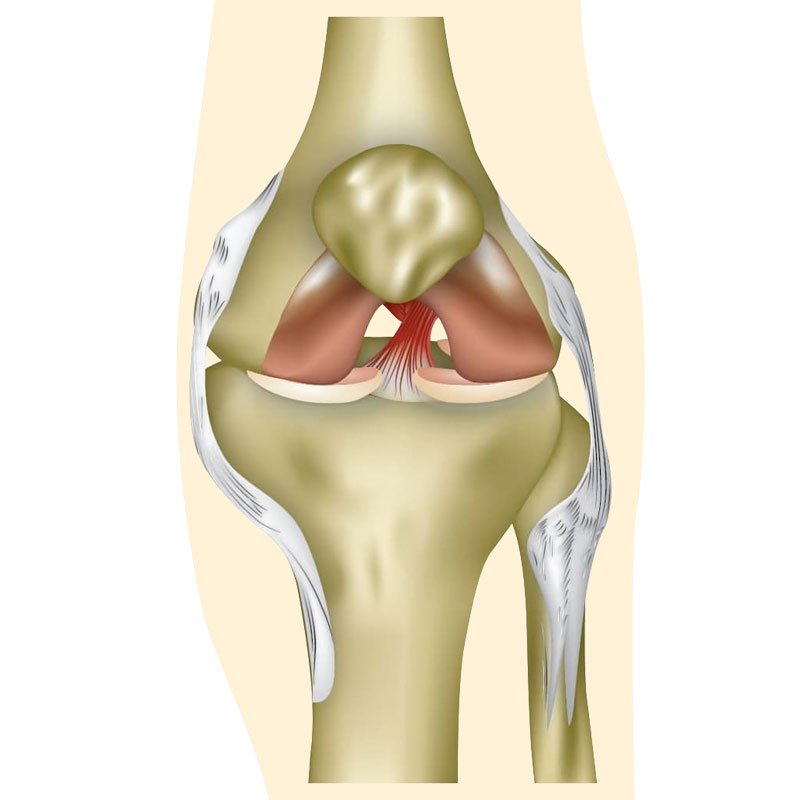Acl Tear stage1 | Global Health