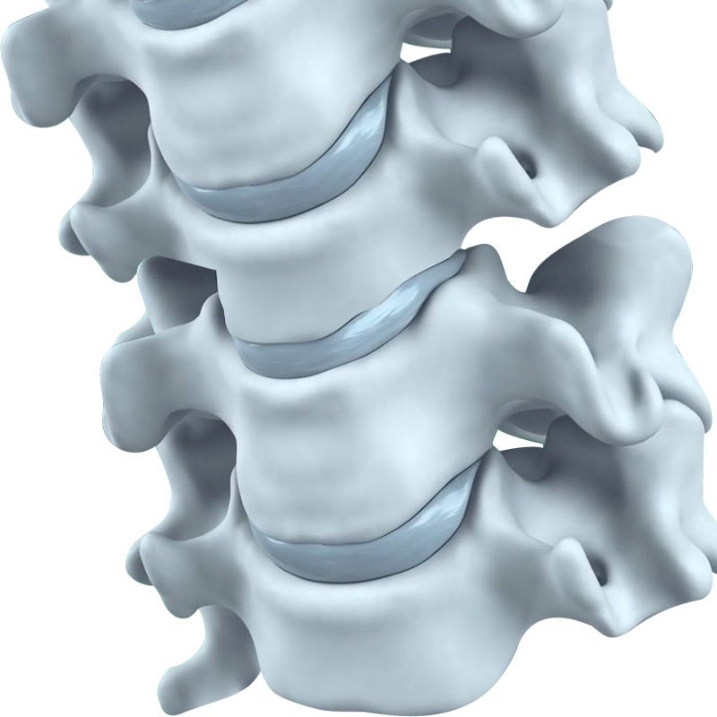 Ankylosing Spondylitis  stage1 | Global Health
