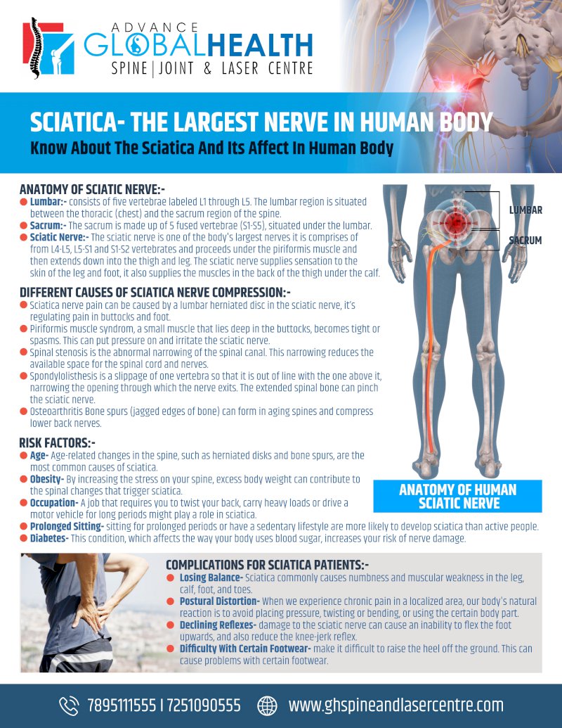 SCIATICA- THE LARGEST NERVE IN HUMAN BODY