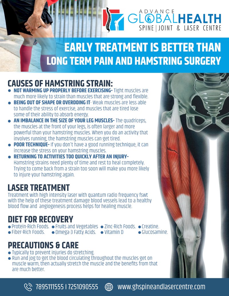 EARLY TREATMENT IS BETTER THAN LONG TERM PAIN AND HAMSTRING SURGERY