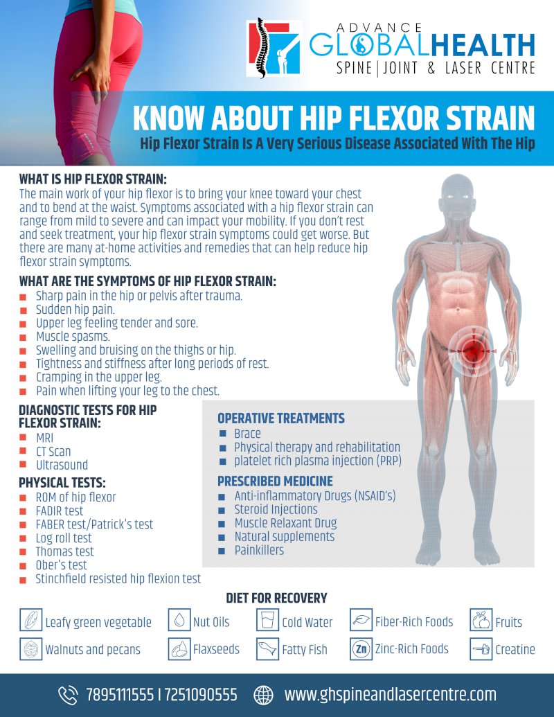 KNOW ABOUT HIP FLEXOR STRAIN: Hip Flexor Strain Is A Very Serious Disease Associated With The Hip