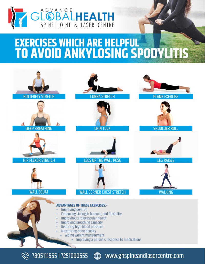EXERCISES WHICH ARE HELPFUL TO AVOID ANKYLOSING SPODYLITIS