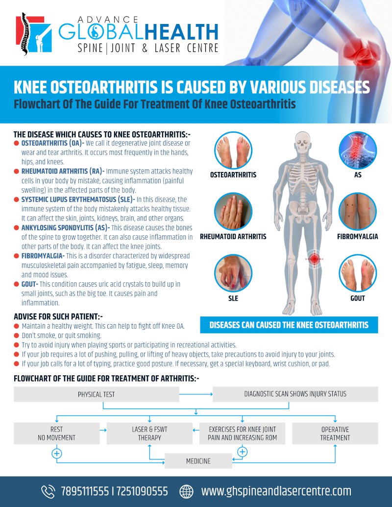KNEE OSTEOARTHRITIS IS CAUSED BY VARIOUS DISEASES Guide For Treatment Of Knee Osteoarthritis