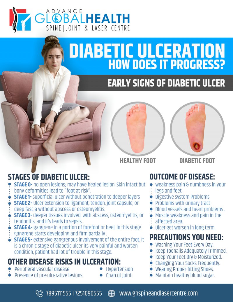 DIABETIC ULCERATION HOW DOES IT PROGRESS: EARLY SIGNS OF DIABETIC ULCER