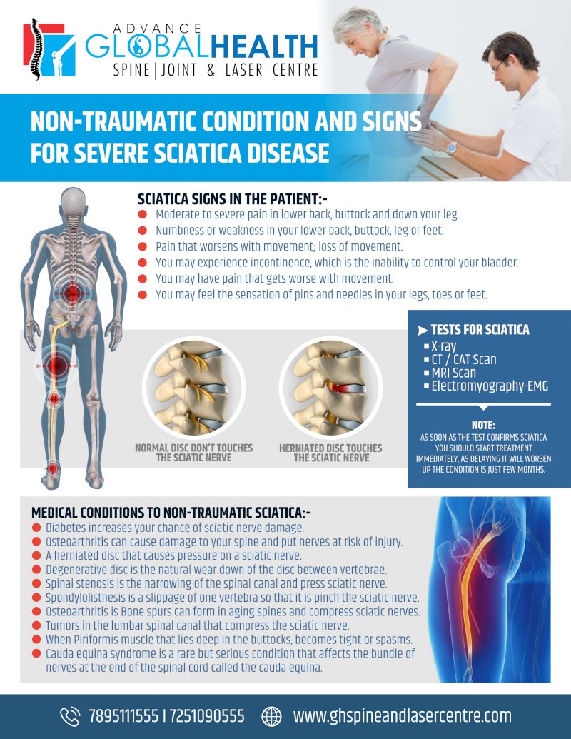 NON-TRAUMATIC CONDITION AND SIGNS FOR SEVERE SCIATICA DISEASE