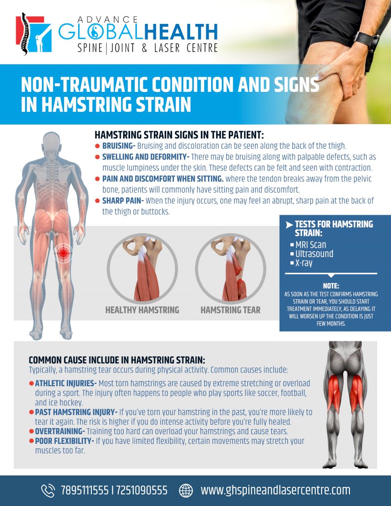NON-TRAUMATIC CONDITION AND SIGNS IN HAMSTRING STRAIN
