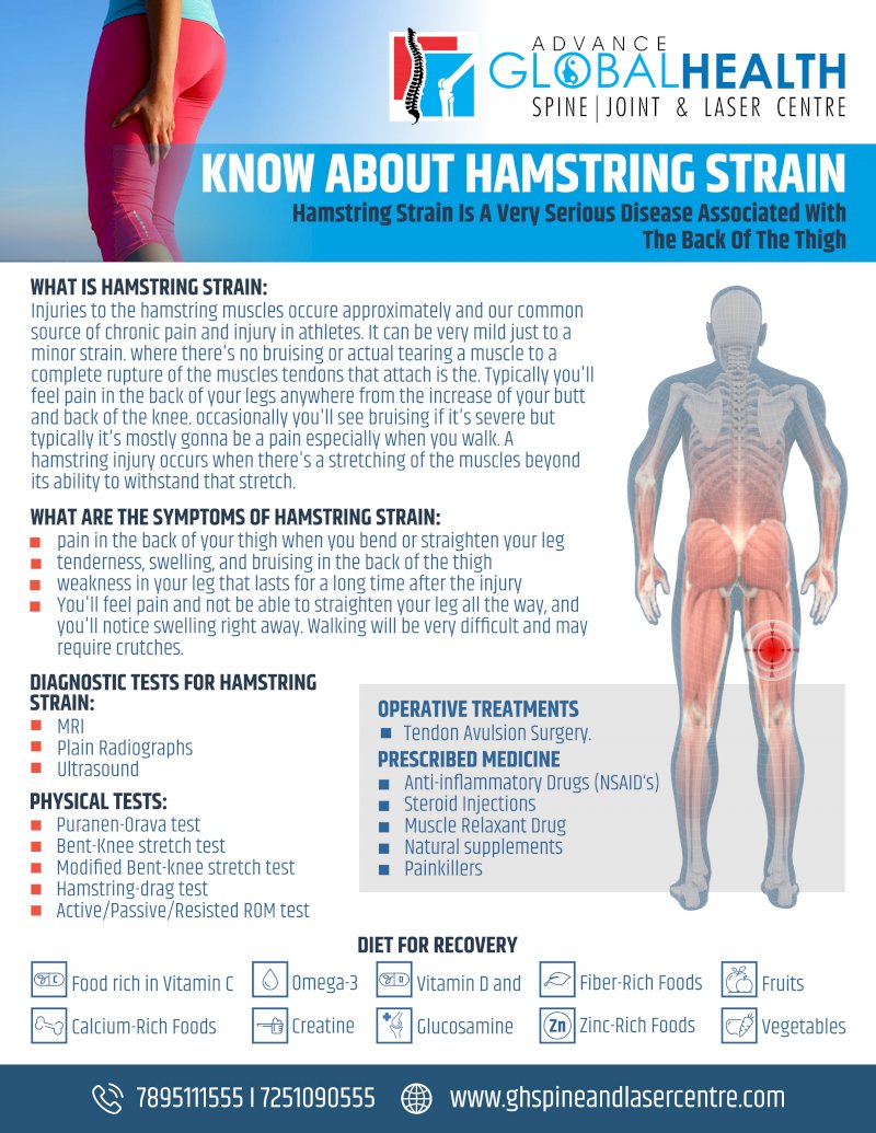 KNOW ABOUT HAMSTRING STRAIN: Hamstring Strain Is A Very Serious Disease Associated With The Back Of The Thigh