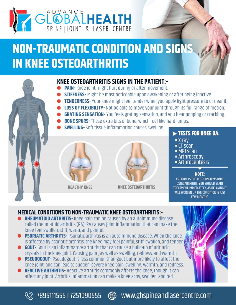 NON-TRAUMATIC CONDITION AND SIGNS IN KNEE OSTEOARTHRITIS