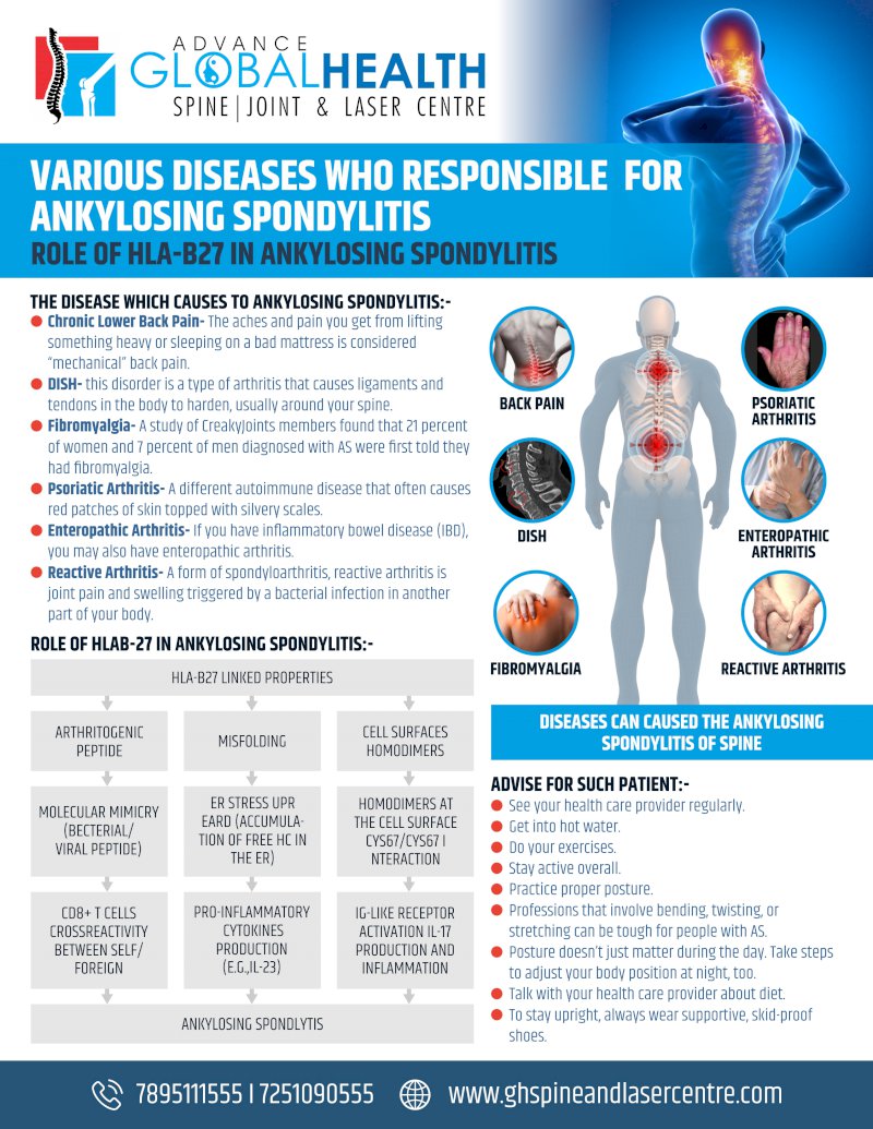 ANKYLOSING SPONDYLITIS IS CAUSED BY VARIOUS DISEASES: ROLE OF HLA-B27 IN ANKYLOSING SPONDYLITIS