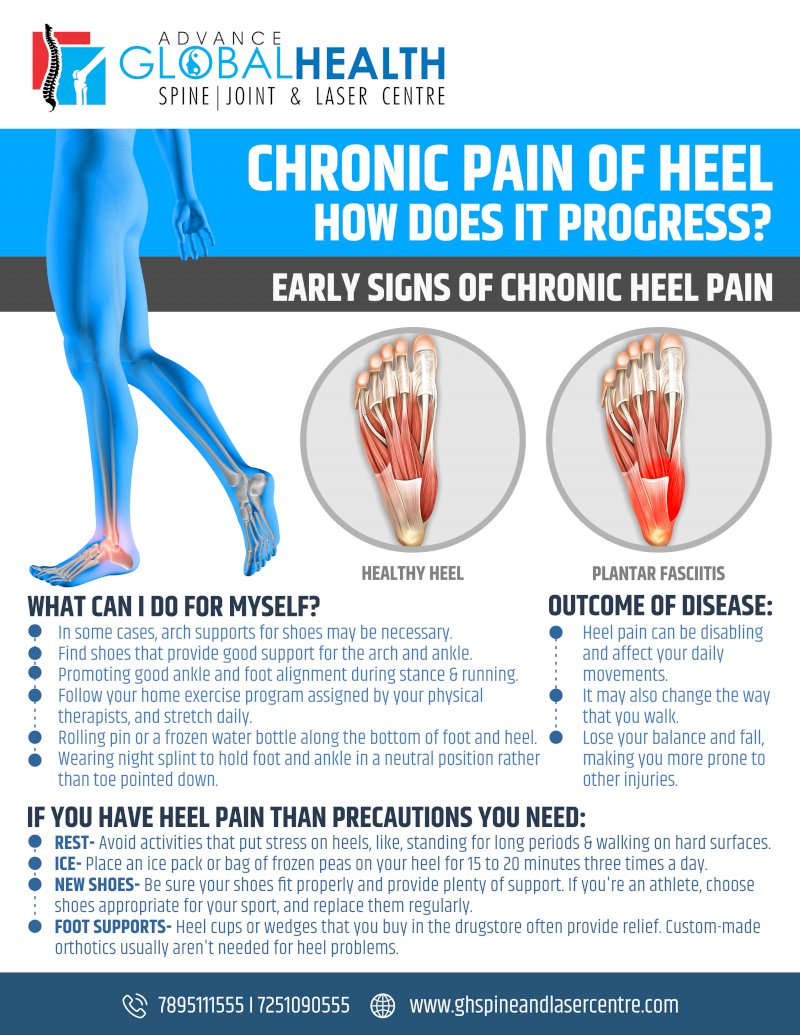 CHRONIC PAIN OF HEEL HOW DOES IT PROGRESS?