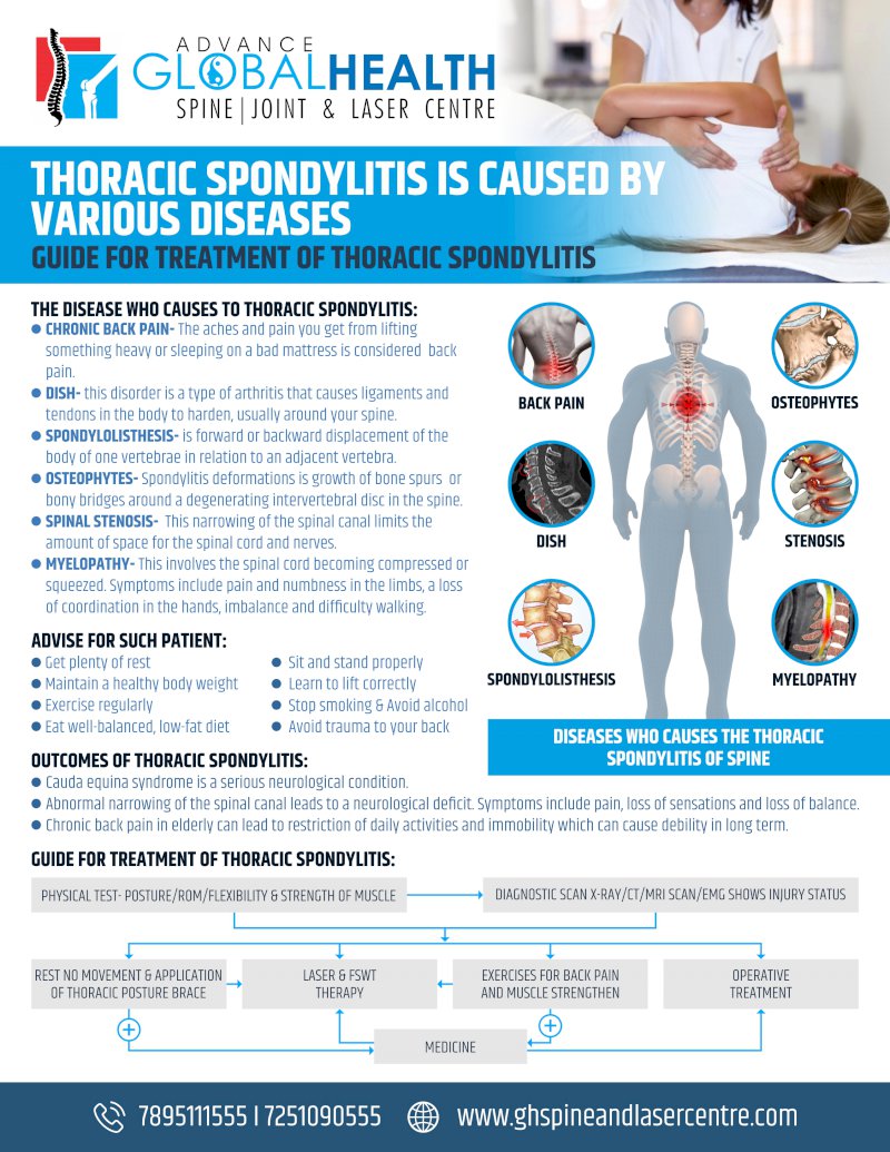 THORACIC SPONDYLITIS IS CAUSED BY VARIOUS DISEASES: GUIDE FOR TREATMENT OF THORACIC SPONDYLITIS
