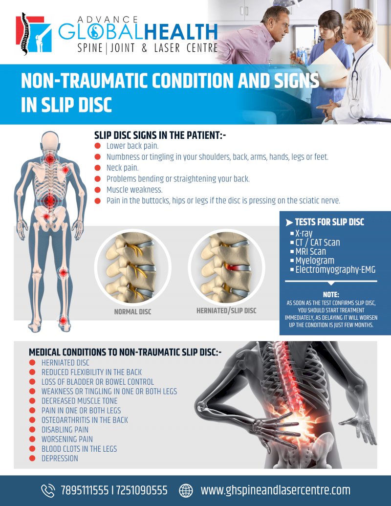 NON-TRAUMATIC CONDITION AND SIGNS IN SLIP DISC