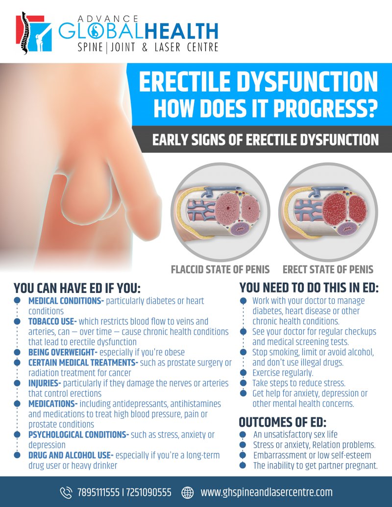 ERECTILE DYSFUNCTION HOW DOES IT PROGRESS: EARLY SIGNS OF ERECTILE DYSFUNCTION