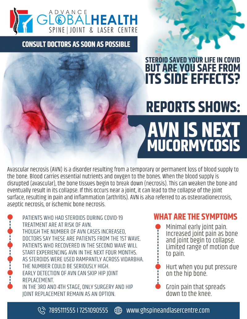 AVN IS NEXT MUCORMYCOSIS  