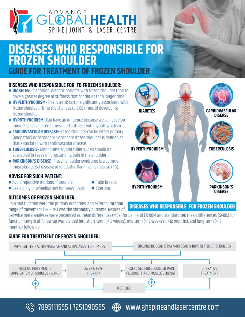 DISEASES WHO RESPONSIBLE FOR FROZEN SHOULDER: GUIDE FOR TREATMENT OF FROZEN SHOULDER