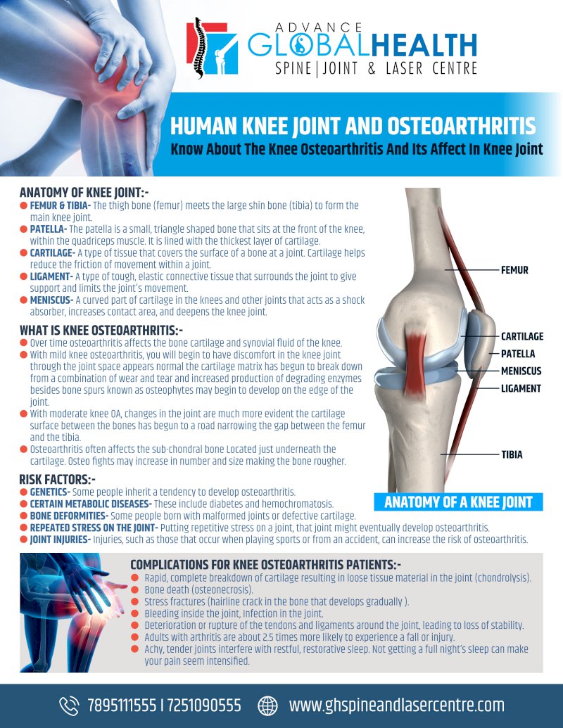 HUMAN KNEE JOINT AND OSTEOARTHRITIS: Knee Osteoarthritis And Its Affect In Knee Joint