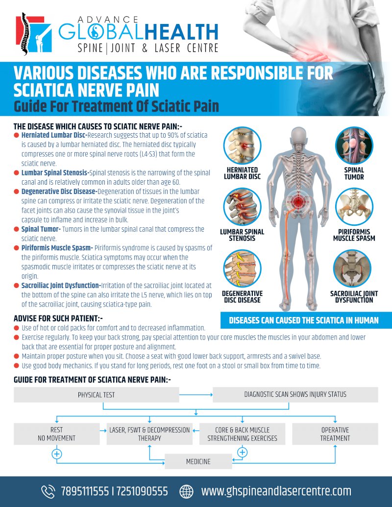 VARIOUS DISEASES WHO ARE RESPONSIBLE FOR SCIATICA NERVE PAIN: GUIDE FOR TREATMENT OF SCIATIC PAIN