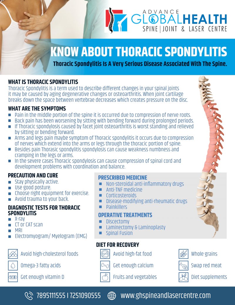 KNOW ABOUT THORACIC SPONDYLITIS: Thoracic Spondylitis Is A Very Serious Disease Associated With The Spine.