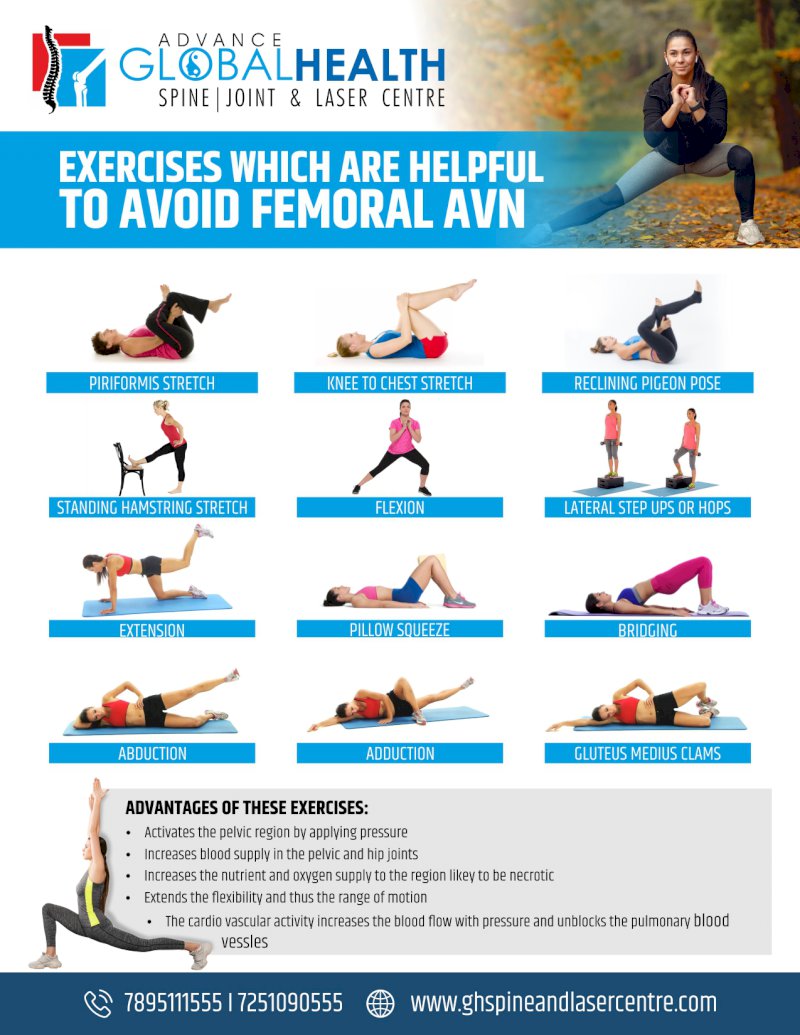 EXERCISES WHICH ARE HELPFUL TO AVOID FEMORAL AVN