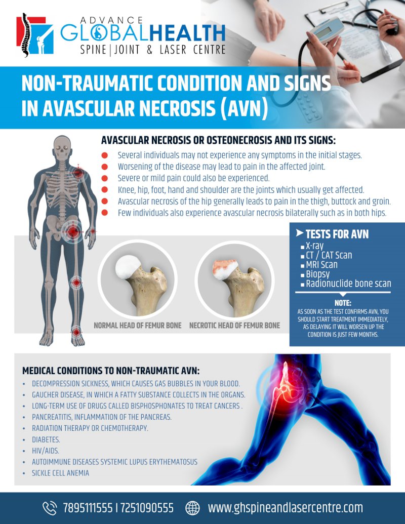 NON-TRAUMATIC CONDITION AND SIGNS  IN AVASCULAR NECROSIS (AVN)