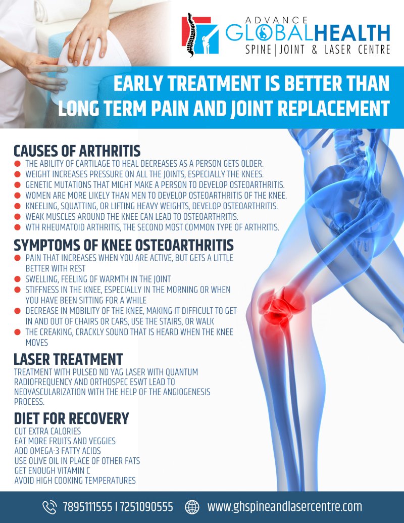EARLY TREATMENT IS BETTER THAN LONG-TERM PAIN AND KNEE JOINT REPLACEMENT