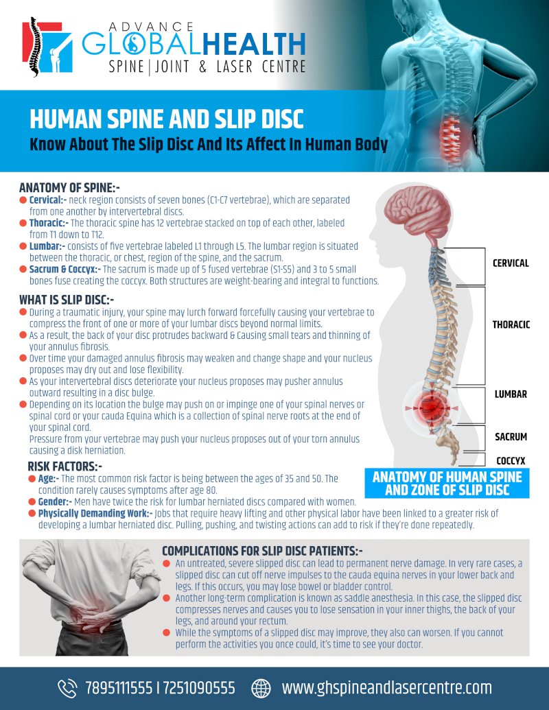 HUMAN SPINE AND SLIP DISC- Know About The Slip Disc And Its Affect In Human Body