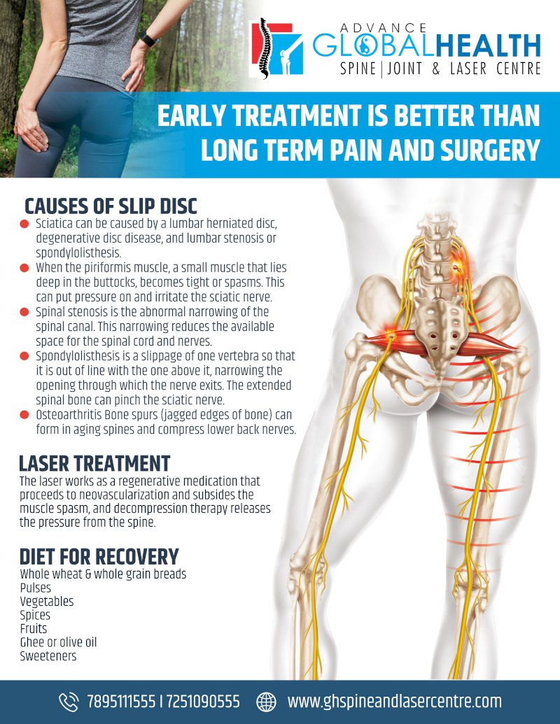 EARLY TREATMENT IS BETTER THAN LONG TERM PAIN AND SURGERY