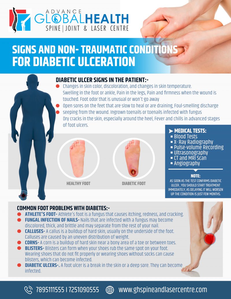 SIGNS AND NON- TRAUMATIC CONDITIONS FOR DIABETIC ULCERATION