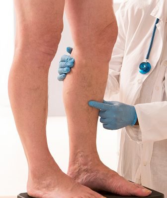Venous Treatment | Global Health