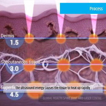 PROCESS | Global Health