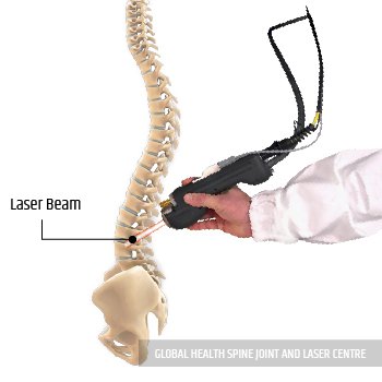 LASER TREATMENT | Global Health