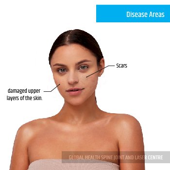 DIAGNOSIS | Global Health