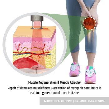 MUSCLE REGENERATION & ATROPHY | Global Health