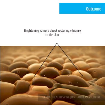 OUTCOME | Global Health