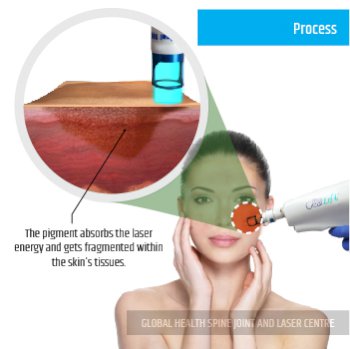 PROCESS | Global Health