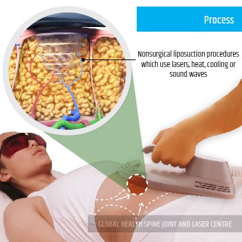 PROCESS | Global Health