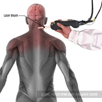 LASER TREATMENT | Global Health
