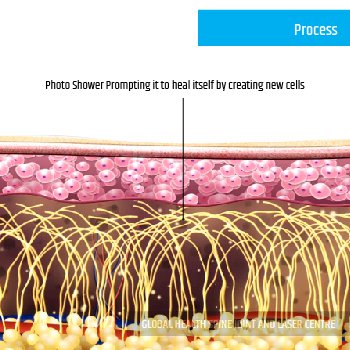 PROCESS | Global Health