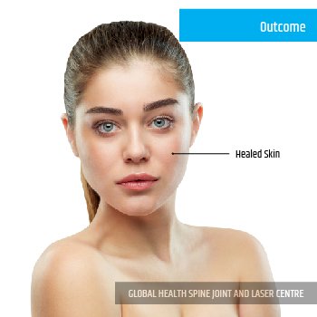 OUTCOME | Global Health