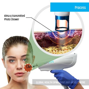 PROCESS | Global Health