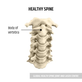 HEALTHY SPINE | Global Health