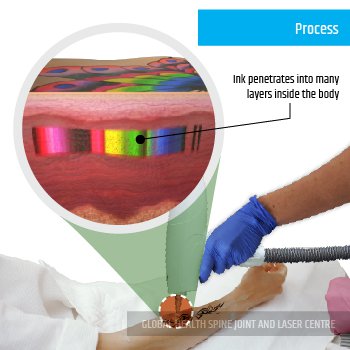 PROCESS | Global Health