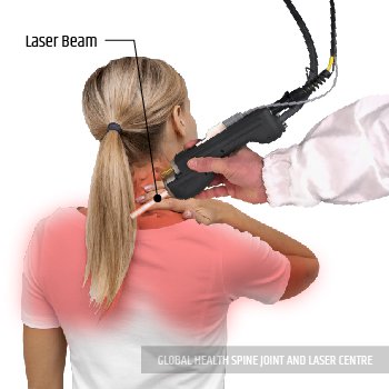 LASER TREATMENT | Global Health