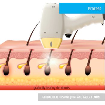 PROCESS | Global Health