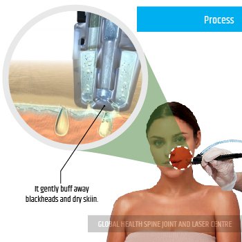 SKIN CLEANING | Global Health