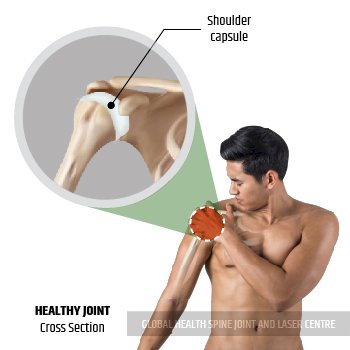 HEALTHY JOINT | Global Health