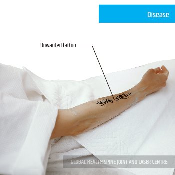 DIAGNOSIS | Global Health
