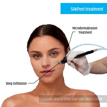 SilkPeel treatment | Global Health