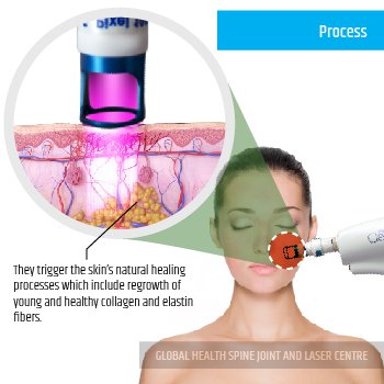PROCESS | Global Health